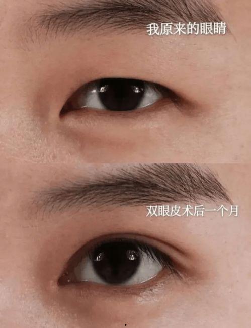 扇形双眼皮明星有谁,扇形双眼皮魅力明星大盘点